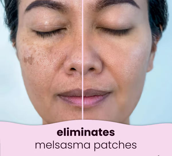 🍋LAST DAY 49% OFF🔥Turmeric Kojic Acid Cleansing Pads