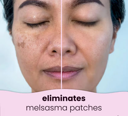 🍋LAST DAY 49% OFF🔥Turmeric Kojic Acid Cleansing Pads