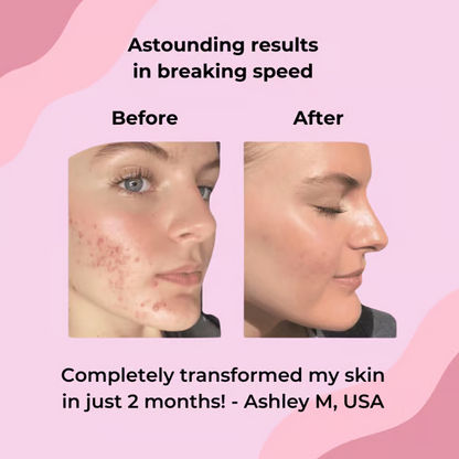 🍋LAST DAY 49% OFF🔥Turmeric Kojic Acid Cleansing Pads