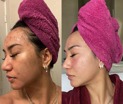 🔥Lemon Turmeric & Kojic Acid Brighetning Soap