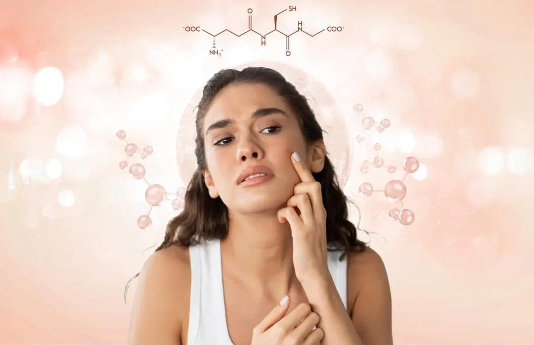 acne glutathione Amazon.com: VAITE Glutathione Whitening Pills - Dark Spots & Acne Scar  Remover - Vegan Skin Bleaching Pills with Anti-Aging & Antioxidant Effect main image 1