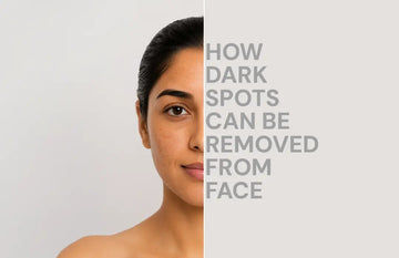 Dark Spot remove