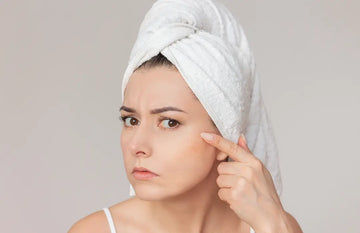 How to Take Care of Dry Skin in Monsoon