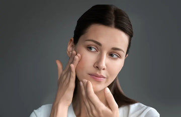 How to Treat Dry Skin on Face
