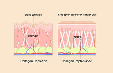 What are the Benefits of Marine Collagen for Skin