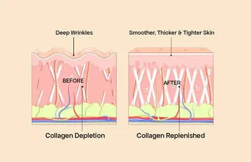 What are the Benefits of Marine Collagen for Skin