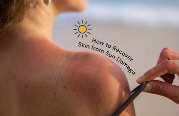 How to Recover Skin from Sun Damage in Summer Days