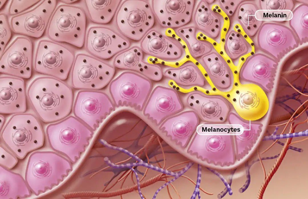 melenic or melanotic Labial melanotic macule. B). Increased numbers of me-lanocytes along main image 1
