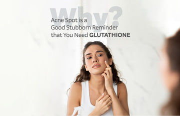 Why Acne Spot is a Good Stubborn Reminder that You Need Glutathione - Glutone