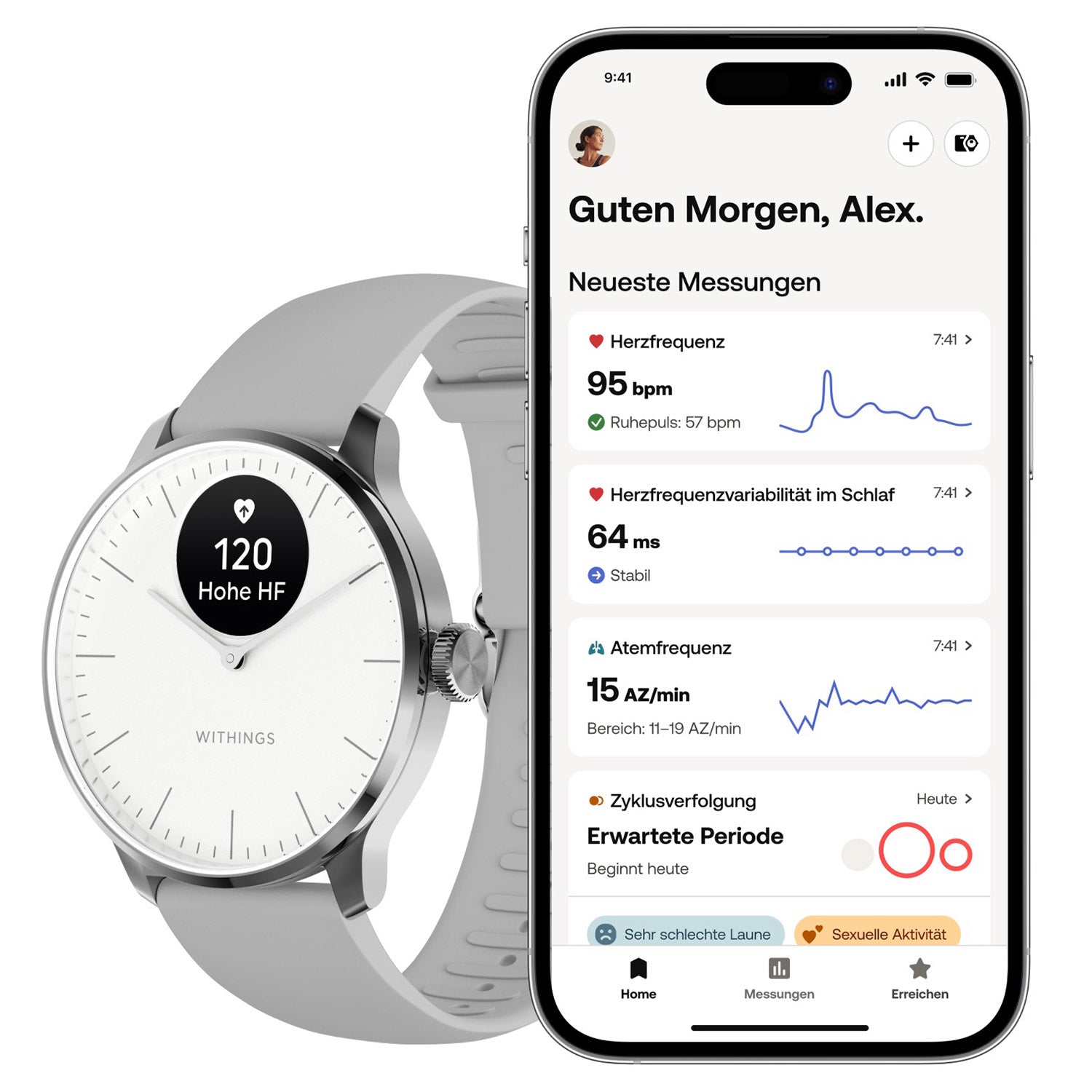 Withings ScanWatch Light Smartwatch neben Smartphone mit Messungsübersicht